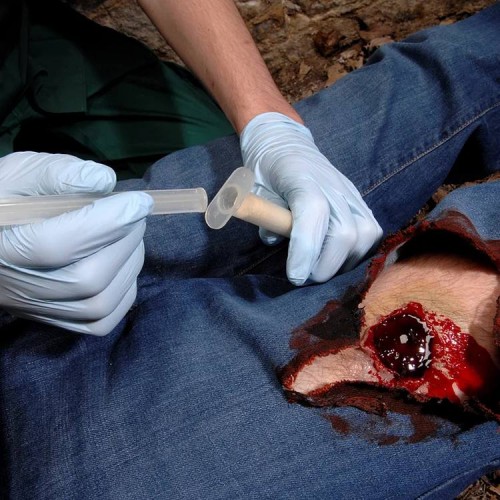 Аппликатор гемостатический с гранулами Rhino Rescue в Ангарске хитозановый