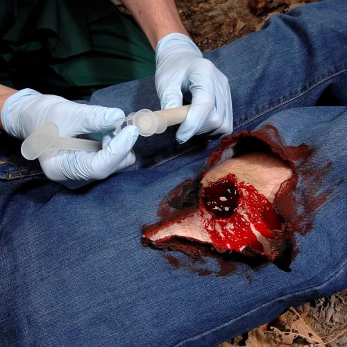 Аппликатор гемостатический с гранулами Rhino Rescue в Ангарске хитозановый